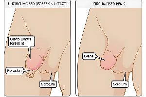 Robotic Surgery