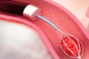Robotic Surgery