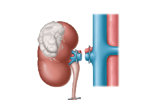 Robotic Surgery