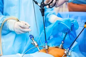 Robotic Surgery